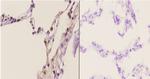 TRIP13 Antibody in Immunohistochemistry (Paraffin) (IHC (P))