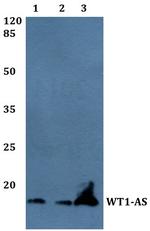 WT1-AS Antibody in Western Blot (WB)