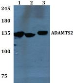 ADAMTS2 Antibody in Western Blot (WB)