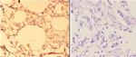 ABCC11 Antibody in Immunohistochemistry (Paraffin) (IHC (P))