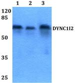 DYNC1I2 Antibody in Western Blot (WB)