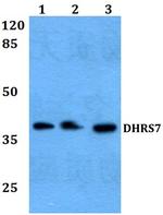 DHRS7 Antibody in Western Blot (WB)