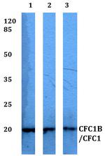 CFC1B/CFC1 Antibody in Western Blot (WB)
