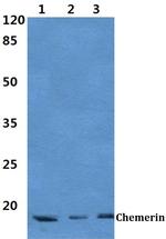 Chemerin Antibody in Western Blot (WB)