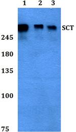 Secretin Antibody in Western Blot (WB)