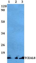 TCEAL8 Antibody in Western Blot (WB)