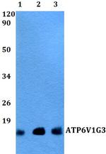 V-ATPase G3 Antibody in Western Blot (WB)