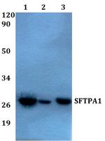 SFTPA1 Antibody in Western Blot (WB)