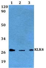 Kallikrein 4 Antibody in Western Blot (WB)