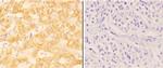 ABHD13 Antibody in Immunohistochemistry (Paraffin) (IHC (P))