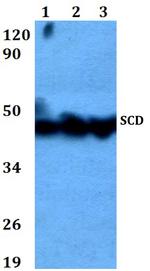 SCD Antibody in Western Blot (WB)