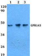 GPR143 Antibody in Western Blot (WB)