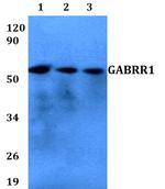 GABRR1 Antibody in Western Blot (WB)