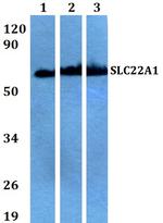 SLC22A1 Antibody in Western Blot (WB)