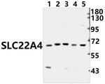 SLC22A4 Antibody in Western Blot (WB)