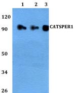 CATSPER1 Antibody in Western Blot (WB)