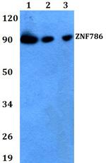 ZNF786 Antibody in Western Blot (WB)