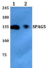 SPAG5 Antibody in Western Blot (WB)