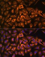 EEF1A1 Antibody in Immunocytochemistry (ICC/IF)