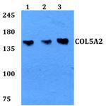 COL5A2 Antibody in Western Blot (WB)