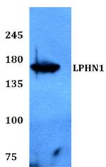 LPHN1 Antibody in Western Blot (WB)