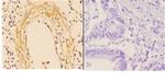 ABCA4 Antibody in Immunohistochemistry (Paraffin) (IHC (P))