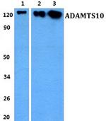 ADAMTS10 Antibody in Western Blot (WB)