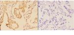 ADAM28 Antibody in Immunohistochemistry (Paraffin) (IHC (P))