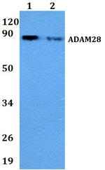 ADAM28 Antibody in Western Blot (WB)