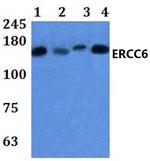 CSB Antibody in Western Blot (WB)