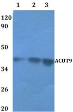 ACOT9 Antibody in Western Blot (WB)