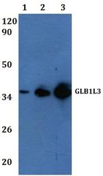 GLB1L3 Antibody in Western Blot (WB)