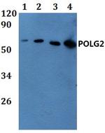 POLG2 Antibody in Western Blot (WB)