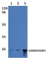 GADD45GIP1 Antibody in Western Blot (WB)