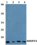 NDUFV3 Antibody in Western Blot (WB)