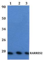 Chemerin Antibody in Western Blot (WB)