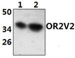 OR2V2 Antibody in Western Blot (WB)