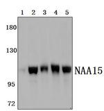 NAA15 Antibody in Western Blot (WB)