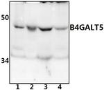 B4GALT5 Antibody in Western Blot (WB)