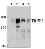 TRPS1 Antibody in Western Blot (WB)