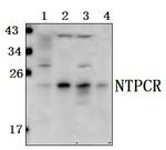 C1orf57 Antibody in Western Blot (WB)