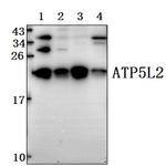 ATP5L2 Antibody in Western Blot (WB)