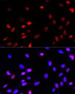 TCF4 Antibody in Immunocytochemistry (ICC/IF)