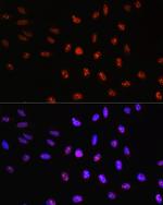 TCF4 Antibody in Immunocytochemistry (ICC/IF)