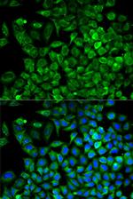 Aldolase A Antibody in Immunocytochemistry (ICC/IF)