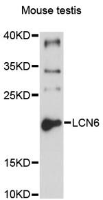 LCN6 Antibody in Western Blot (WB)