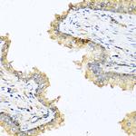 DEFB121 Antibody in Immunohistochemistry (Paraffin) (IHC (P))