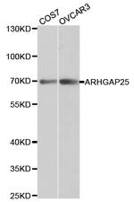 ARHGAP25 Antibody in Western Blot (WB)