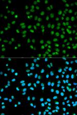 Cystatin 8 Antibody in Immunocytochemistry (ICC/IF)