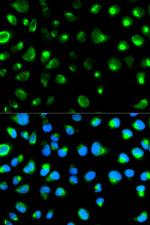 GYPC Antibody in Immunocytochemistry (ICC/IF)